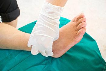 Wound care treatment in the Encino, CA 91316 and Los Angeles, CA 90049 areas