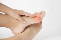 How Can I Prevent a Bunion?